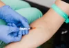 Jakie badania laboratoryjne warto wykonać, mieszkając w Gliwicach? lab-med.pl - 246-jakie-badania-laboratoryjne-warto-wykonac-mieszkajac-w-gliwi.webp